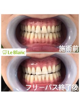 ルブラン 奈良店(Le Blanc)/最低保証付きフリーパス！