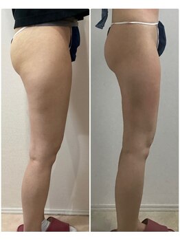 プリマプリート 可児店/リバウンドなし!　最新脂肪冷却!