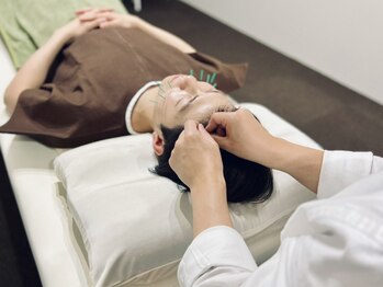 フラット(flat)/小顔美容鍼メンズにもオススメ