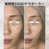 ビープラスサロン(Be plus salon)