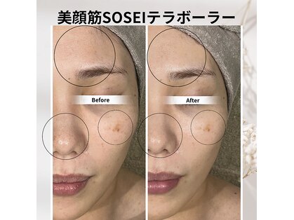 ビープラスサロン(Be plus salon)の写真