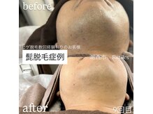 ルチルス(Rutiles)の雰囲気（最先端ハイブリッド脱毛★メンズ脱毛★ヒゲ脱毛★おまかせ下さい）