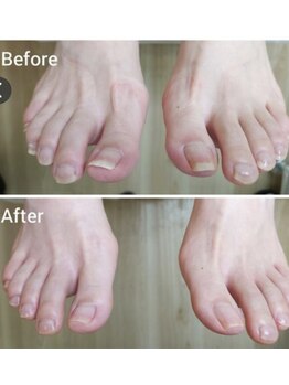 人気No.1 フット&ハンドケア