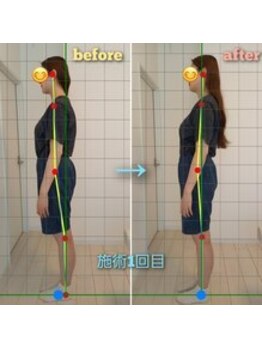 札幌ウィメンズ整体院/股関節可動域、骨盤矯正