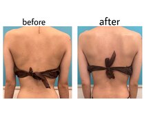 ブーティサロン(BOOTY SALON)/◇背中すっきりケア◇