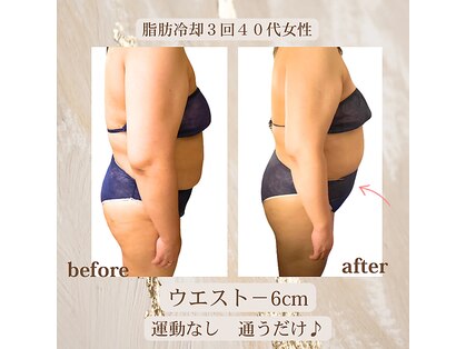 ラベージャ(La Bella)の写真