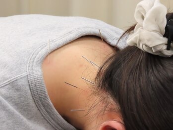 クレーン整骨院 平岸3条店/鍼灸施術もやってます！