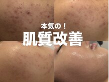 ベリア 広尾(BelLia)/リアボーテ★４代トリートメント