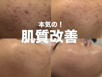 ベリア 広尾(BelLia)/リアボーテ★4代トリートメント