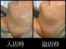 ビーエルティー(blt)/レモンボトル