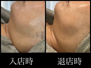 ビーエルティー(blt)/レモンボトル