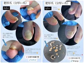 トラブルネイル