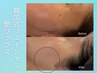 【艶肌フェイスワックスで月1肌管理】産毛＋角質＋肌管理ワンランク上の美肌