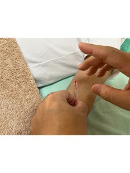 鍼灸施術を受けたい