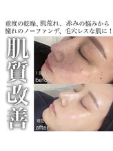 ベル(Belle)/セルマン