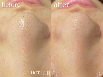 ベベクロスディディア 野々市市役所前店(Bebe×DiDiA)/お肌変化