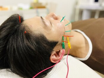 フラット(flat)/小顔美容鍼メンズにもオススメ