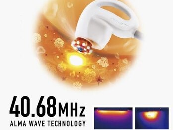 ハッピーハンド(HAPPY HAND)/新型サーモシェイプOpus導入！