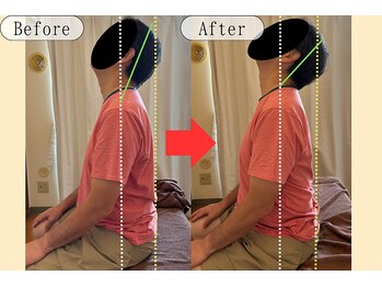 シェアハピネス たまプラーザ(share happiness)/Before＆After