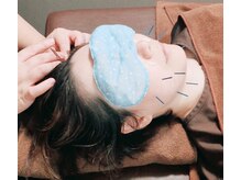 代官山アサ接骨院 鍼灸院(代官山 Asa 接骨院 鍼灸院)/眼精疲労と食いしばりケアに◎