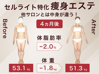 ラ パルレ 梅田本店/全身引き締めセルライトケア