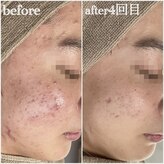 エミルカ 千葉店(EMILUCA)