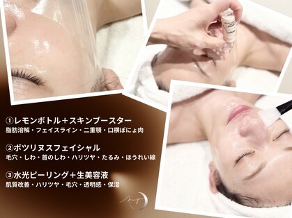 アンフェム(Anfem)の写真