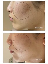 エモベーシック(e'MO BASIC)/