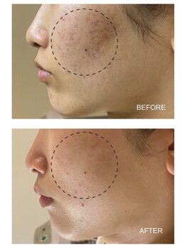 エモベーシック(e'MO BASIC)/