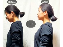 いのくち接骨院の雰囲気（痛みの原因となる体の歪み・姿勢を改善します。）