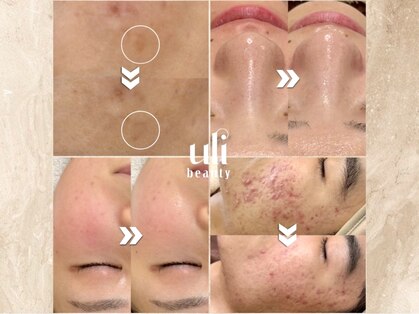 ウリ(uli beauty)の写真