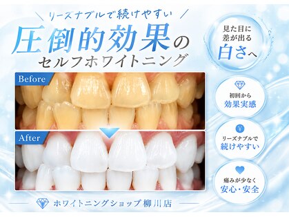 ホワイトニングショップ 柳川店の写真
