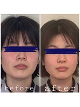 マリーゴールド(marigold)/器具を使わないのに小顔効果