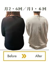ロータス(LOTUS)/カラダの美容骨格術（経過写真）