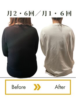 ロータス(LOTUS)/カラダの美容骨格術（経過写真）