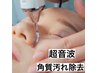 【肌の角質汚れごっそり】超音波洗浄マシンで皮脂や角質を除去7000円→5000円