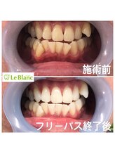 ルブラン 奈良店(Le Blanc)/男性のお客様！