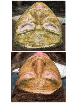 ソウ(SOU)の写真/【フェイシャルエステ人気No.1】ハーブピーリング◎初めての方にもオススメ！乾燥肌対策に☆
