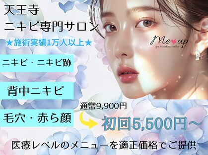 ミーアップ(Me up)の写真