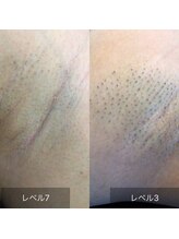 アネル 宮古島店(anel)/