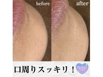 ブリリアント(brilliant)/フェイシャルワックス