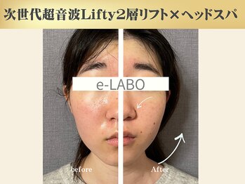 イーラボ 池袋店(e-LABO)/フェイスラインすっきり小顔♪