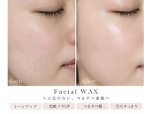 アイディアル スペース(ideal space)の雰囲気(人気!【顔ワックス】産毛汚れ角質除去して、お肌リセット!)