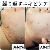 サロン ド ボーテ プルーラ(Salon de beaute PLURA)