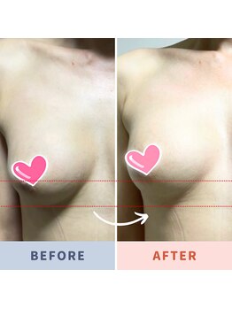 美バリ 新宿店(美BARI)/エアバリで爆乳体験