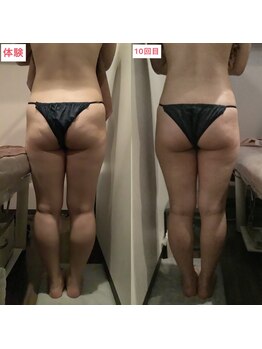 ビタミンスパ 中野店/-3.9cmダウン★施術回数10回