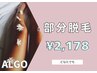 【部分脱毛】全身63部位(顔VIO含む)からセレクト!!◆1箇所◆ ¥2,178