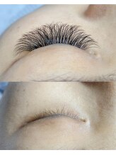 チルザルト サロン/3D開花ボリューム