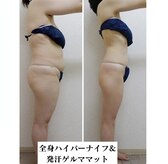 グレースフル