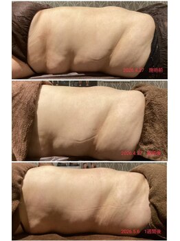 美プレミアム 越谷店/レッドショットで理想のBodyへ☆